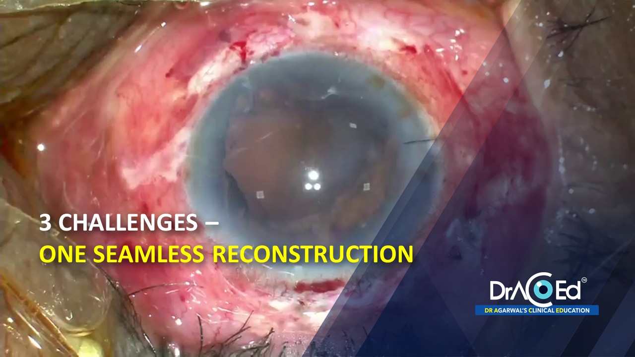 3 challenges   one seamless reconstruction