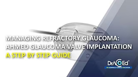 Managing Refractory Glaucoma Ahmed Glaucoma Valve Implantation A Step by Step Guide