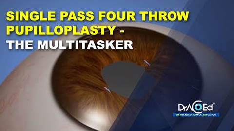 SFT - The multitasker