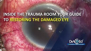 Inside the Trauma Room Your Guide to Restoring the Damaged Eye