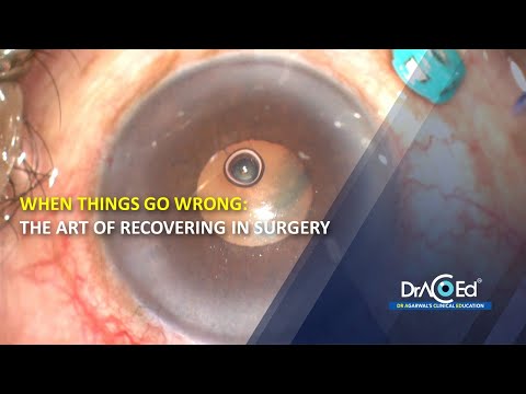 When Things Go Wrong The Art of Recovering in Surgery