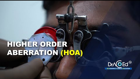 Higher Order Aberration (HOA)